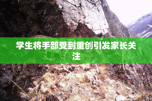 学生将手部受到重创引发家长关注