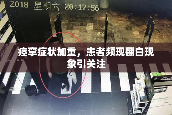 痉挛症状加重，患者频现翻白现象引关注