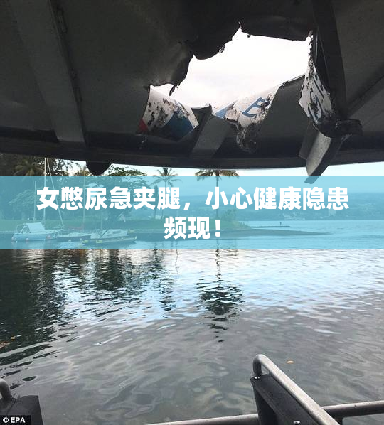 女憋尿急夹腿，小心健康隐患频现！