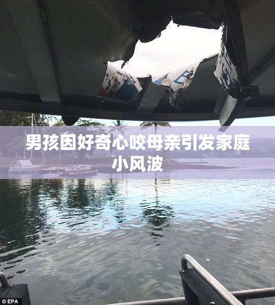 男孩因好奇心咬母亲引发家庭小风波