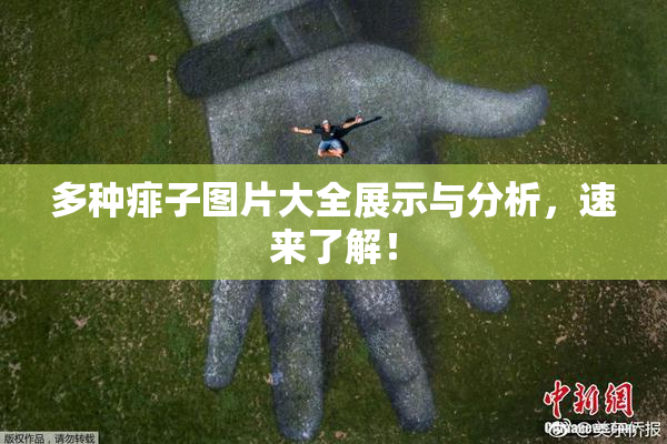 多种痱子图片大全展示与分析，速来了解！