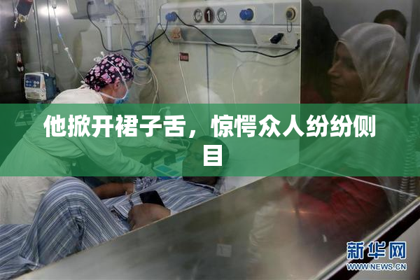 他掀开裙子舌，惊愕众人纷纷侧目