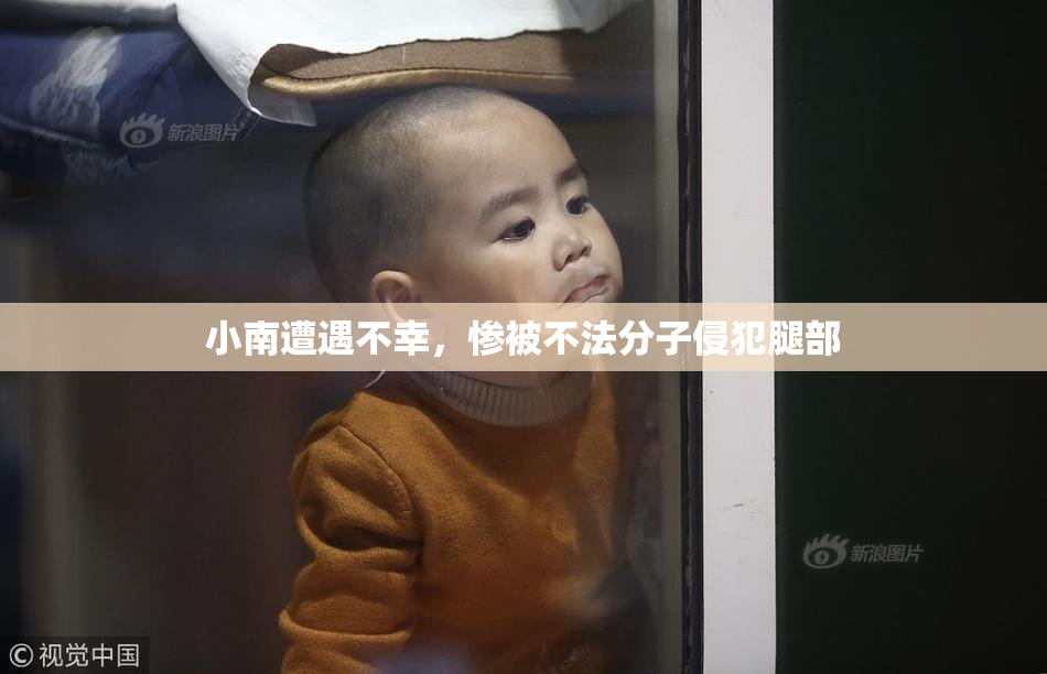 小南遭遇不幸，惨被不法分子侵犯腿部