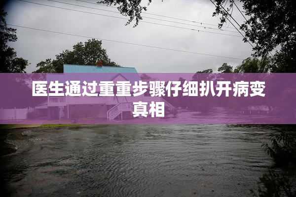 医生通过重重步骤仔细扒开病变真相