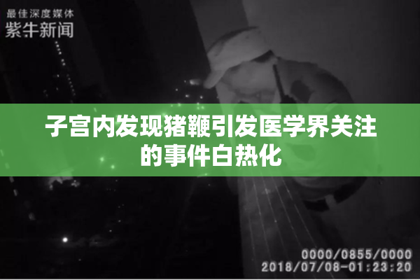 子宫内发现猪鞭引发医学界关注的事件白热化