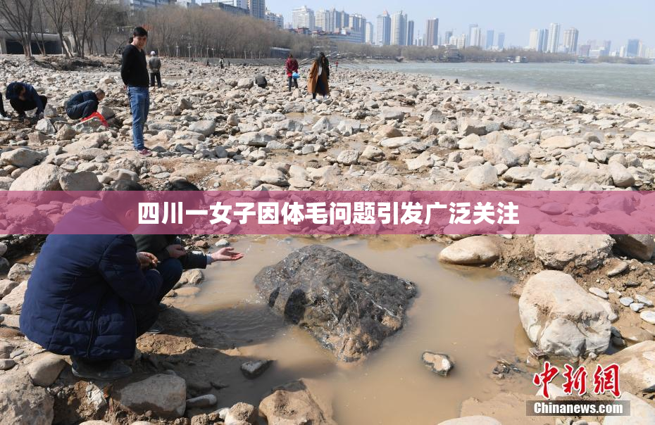 四川一女子因体毛问题引发广泛关注