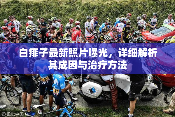 白痱子最新照片曝光，详细解析其成因与治疗方法