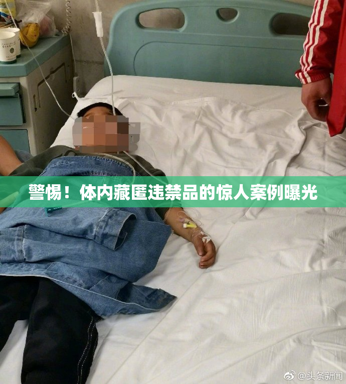 警惕！体内藏匿违禁品的惊人案例曝光