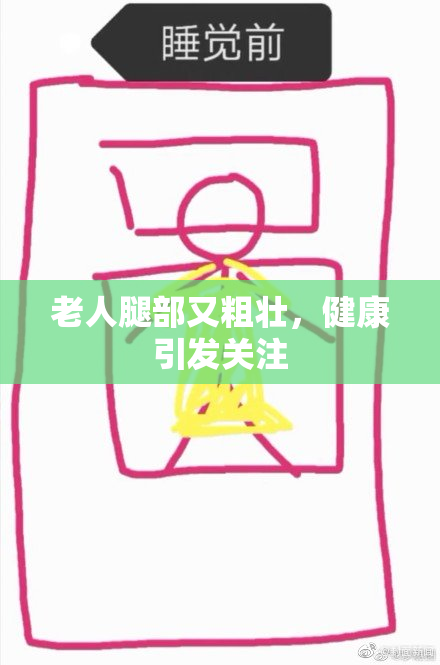 老人腿部又粗壮，健康引发关注