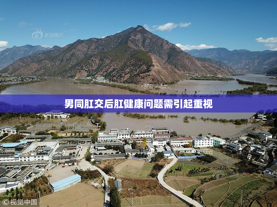 男同肛交后肛健康问题需引起重视