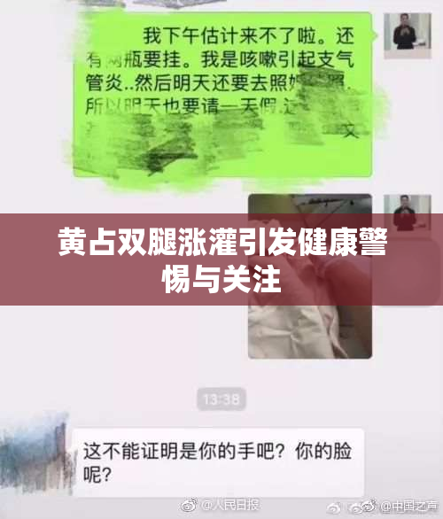 黄占双腿涨灌引发健康警惕与关注